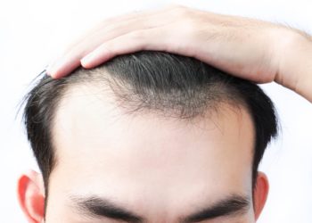 minoxidil para que serve