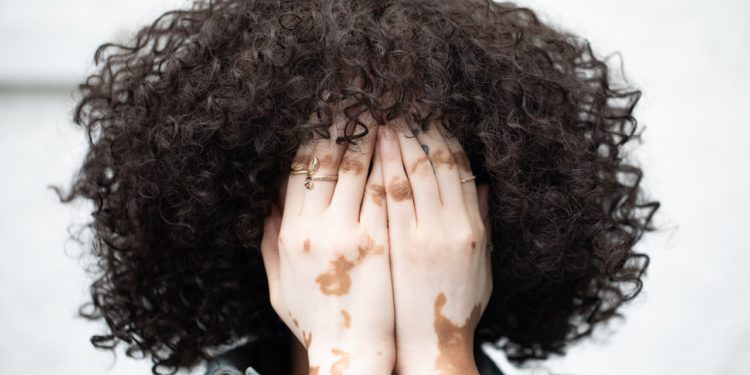 Mamacadela para que serve?